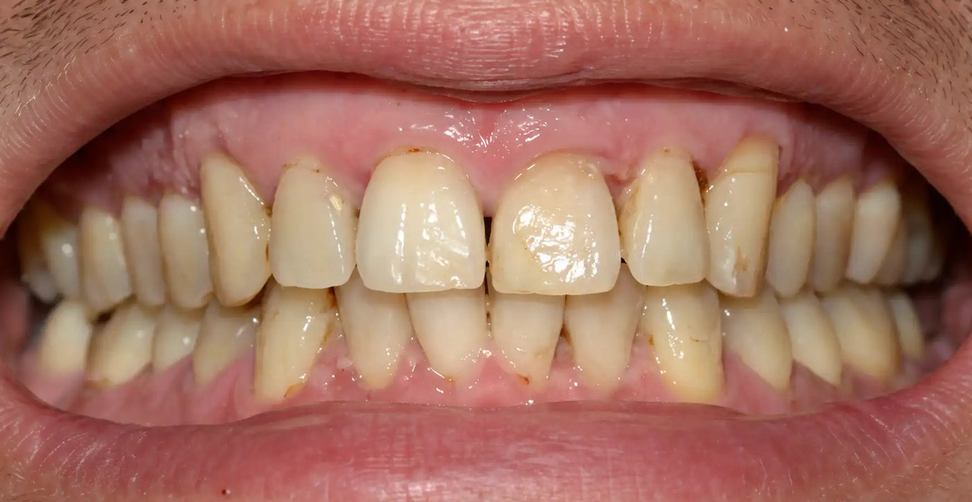 Before image